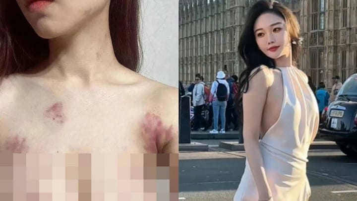 Shocking! Chinese influencer with millions of followers lured to the Philippines by close friend, kidnapped for 25.8 million baht ransom, and ultimately murdered